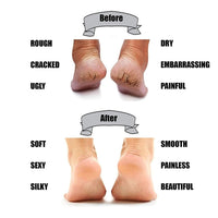 Silicon Gel Pad Heel Protector Socks